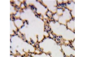 Used in DAB staining on fromalin fixed paraffin-embedded Lung tissue (SH2D1A antibody  (AA 18-115))