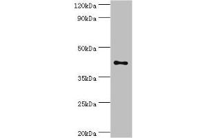 Western blot All lanes: Transcription factor Dp-1 antibody at 2 μg/mL + HepG2 whole cell lysate Secondary Goat polyclonal to rabbit IgG at 1/10000 dilution Predicted band size: 46, 35 kDa Observed band size: 46 kDa (DP1 antibody  (AA 1-290))