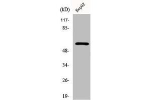 Western Blot analysis of 293 cells using Dab1 Polyclonal Antibody (DAB1 antibody)