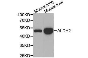 Western blot analysis of extracts of various cell lines, using ALDH2 antibody. (ALDH2 antibody  (AA 1-380))