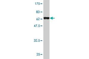 Western Blot detection against Immunogen (62. (GNAI2 antibody  (AA 1-339))