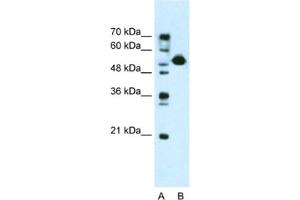 Western Blotting (WB) image for anti-DKFZP781I1119 antibody (ABIN2461018) (DKFZP781I1119 antibody)