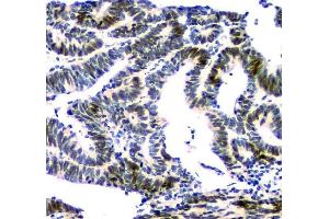 IHC analysis of NFIA using anti-NFIA antibody (ABIN6719349). (NFIA antibody  (Middle Region))