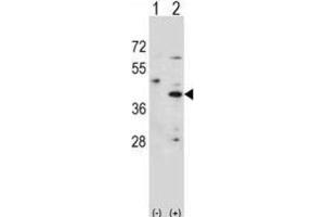 Western Blotting (WB) image for anti-Hydroxy-delta-5-Steroid Dehydrogenase, 3 beta- and Steroid delta-Isomerase 1 (HSD3B1) antibody (ABIN2998094)