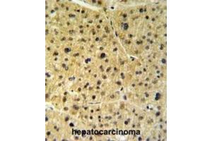 Immunohistochemistry (IHC) image for anti-FK506 Binding Protein 9, 63 KDa (FKBP9) antibody (ABIN3003182) (FKBP9 antibody)