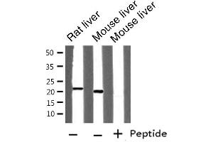 Western blot analysis of FTH1 expression in various lysates (FTH1 antibody  (C-Term))