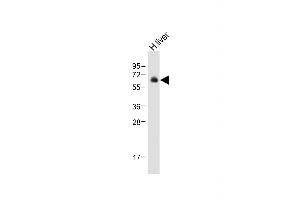 Anti-UGT2B15 Antibody (Center) at 1:500 dilution + Human liver tissue lysate Lysates/proteins at 20 μg per lane. (UGT2B15 antibody  (AA 156-185))