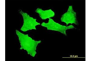 Immunofluorescence of monoclonal antibody to CDKL2 on HeLa cell.