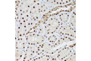 Immunohistochemistry of paraffin-embedded rat kidney using PSME3 Rabbit pAb (ABIN6135015, ABIN6146357, ABIN6146358 and ABIN6216428) at dilution of 1:100 (40x lens). (PSME3 antibody  (C-Term))
