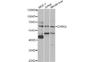 Western blot analysis of extracts of various cell lines, using DYRK2 antibody (ABIN5974219) at 1/1000 dilution. (DYRK2 antibody)