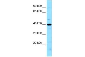 WB Suggested Anti-LIMS2 Antibody Titration: 1. (LIMS2 antibody  (N-Term))
