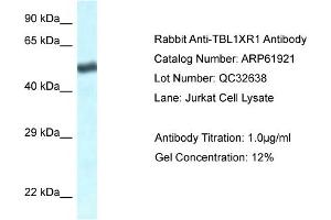 Western Blotting (WB) image for anti-Transducin (Beta)-Like 1 X-Linked Receptor 1 (TBL1XR1) (C-Term) antibody (ABIN2788949) (TBL1XR1 antibody  (C-Term))