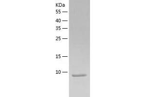 Western Blotting (WB) image for Chemokine (C-X-C Motif) Ligand 14 (CXCL14) (AA 35-111) protein (His tag) (ABIN7284750) (CXCL14 Protein (AA 35-111) (His tag))