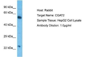 Host:  Rabbit  Target Name:  CGAT2  Sample Type:  HepG2 Whole Cell lysates  Antibody Dilution:  1. (CSGALNACT2 antibody  (N-Term))