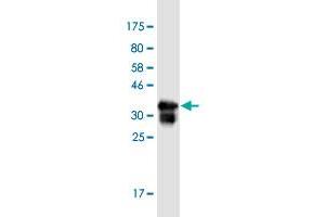 ADAMTS15 antibody  (AA 863-950)