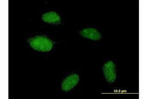 Immunofluorescence of purified MaxPab antibody to POGZ on HeLa cell. (POGZ antibody  (AA 1-1357))