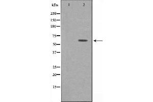 Western blot analysis of extracts from HepG2 cells, using ATP6V1B1 antibody. (ATP6V1B1 antibody  (Internal Region))