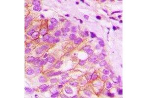 Immunohistochemistry (IHC) image for anti-TAP Binding Protein (Tapasin) (TAPBP) antibody (ABIN7308398) (TAPBP antibody)