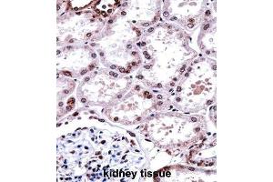 Immunohistochemistry (IHC) image for anti-Forkhead Box D1 (FOXD1) antibody (ABIN2997954) (FOXD1 antibody)