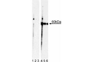 Western blot analysis of Akt (pT308). (AKT1 antibody  (pThr308))