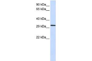 WB Suggested Anti-C21orf2  Antibody Titration: 0. (C21orf2 antibody  (N-Term))