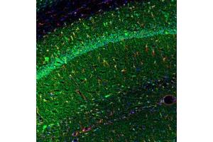 Image no. 1 for anti-Tumor Necrosis Factor alpha (TNF alpha) antibody (ABIN465805)