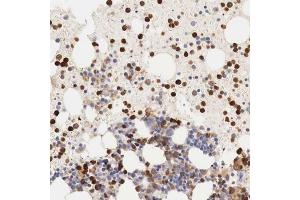 Immunohistochemical staining of human bone marrow with G6PD polyclonal antibody  shows distinct positivity in subsets of hematopoietic cells at 1:200-1:500 dilution. (Glucose-6-Phosphate Dehydrogenase antibody)