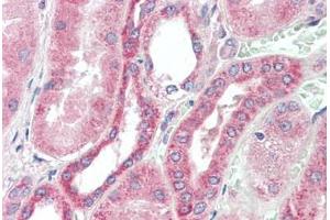 Human Kidney: Formalin-Fixed, Paraffin-Embedded (FFPE) (RDH10 antibody  (AA 71-120))