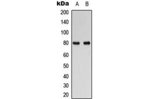 Western blot analysis of RAD17 expression in human Oral cancer (A), HuvEc (B) whole cell lysates. (RAD17 antibody  (C-Term))
