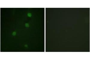 Immunofluorescence analysis of NIH-3T3 cells, using Retinoblastoma (Ab-821) Antibody. (Retinoblastoma Protein (Rb) antibody  (AA 791-840))