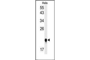 Western blot analysis of IMP3 Antibody (C-term) in Hela cell line lysates (35ug/lane). (IMP3 antibody  (C-Term))