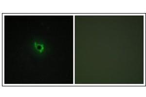 Immunofluorescence analysis of COS7 cells, using EPHA6 Antibody. (EPH Receptor A6 antibody  (C-Term))