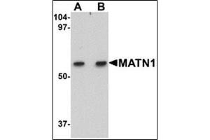 Western blot analysis of MATN1 in rat liver tissue lysate with this product at (A) 1 and (B) 2 μg/ml.