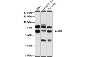 Western blot analysis of extracts of various cell lines, using GLYR1 antibody. (GLYR1 antibody)