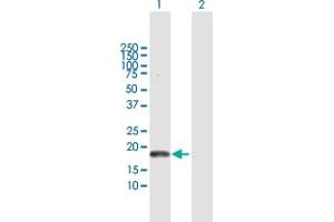 Western Blot analysis of PLA2G16 expression in transfected 293T cell line by PLA2G16 MaxPab polyclonal antibody. (PLA2G16 antibody  (AA 1-162))