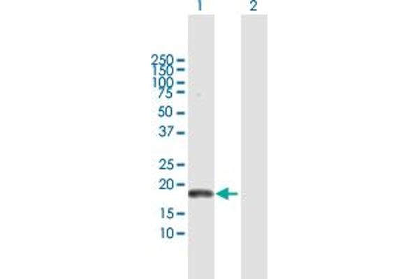 PLA2G16 antibody  (AA 1-162)