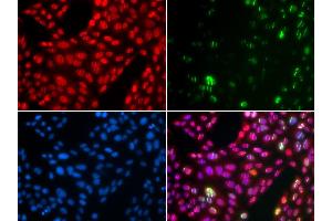 Immunofluorescence analysis of U2OS cells using CUL4B antibody (ABIN6130211, ABIN6139255, ABIN6139258 and ABIN6221048). (Cullin 4B antibody  (AA 1-200))