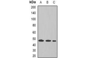 Western blot analysis of Tapasin expression in THP1 (A), Raji (B), mouse liver (C) whole cell lysates. (TAPBP antibody  (full length))