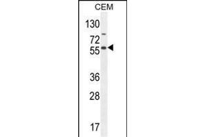NFKBIL1 Antibody (Center) (ABIN654639 and ABIN2844336) western blot analysis in CEM cell line lysates (35 μg/lane).