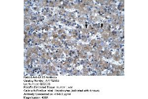 Rabbit Anti-LHX6 Antibody     Paraffin Embedded Tissue: Human Liver  Cellular Data: Hepatocytes  Antibody Concentration: 4. (LHX6 antibody  (C-Term))