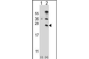 Western blot analysis of CD3E (arrow) using rabbit polyclonal CD3E Antibody (C-term) (ABIN657454 and ABIN2846481). (CD3 epsilon antibody  (C-Term))