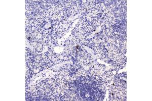 IHC analysis of HE4 using anti-HE4 antibody (ABIN5693137). (WFDC2 antibody  (AA 31-124))