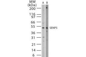 Image no. 1 for anti-SUMO1/sentrin Specific Peptidase 5 (SENP5) (AA 229-246) antibody (ABIN208763) (SENP5 antibody  (AA 229-246))