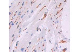 Used in DAB staining on fromalin fixed paraffin- embedded heart tissue (CCRK antibody  (AA 4-288))