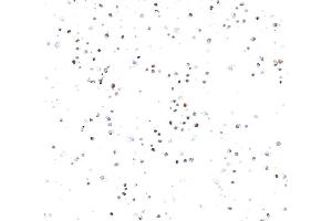 Immunocytochemistry (ICC) image for anti-Topo IIalpha (AA 650-700) antibody (ABIN7795794) (Recombinant Topo IIalpha (AA 650-700) antibody)