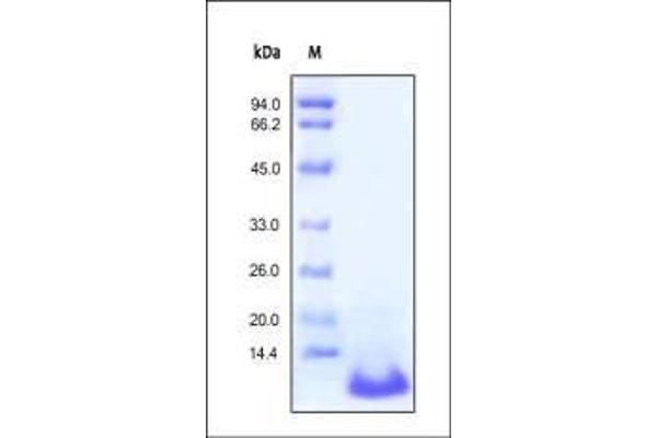 C5A Protein (AA 679-751)