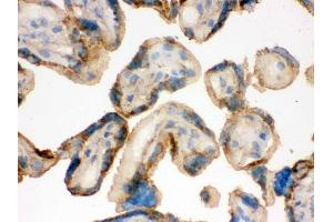 Immunohistochemistry (IHC) image for anti-Isocitrate Dehydrogenase 2 (NADP+), Mitochondrial (IDH2) (AA 413-447), (C-Term) antibody (ABIN3043856)