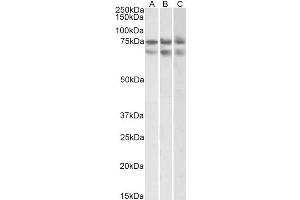 ABIN2613433 (2µg/ml) staining of HeLa (A)HepG2 (B) and K562 (C) nuclear lysates (35µg protein in RIPA buffer). (Nucleostemin antibody  (Internal Region))