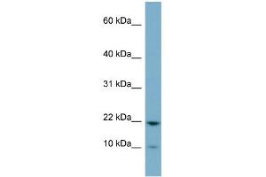 WB Suggested Anti-D15Wsu75e Antibody Titration:  0. (DESI1 antibody  (Middle Region))