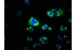 Immunofluorescence staining of A549 cells with ABIN7146518 at 1:100, counter-stained with DAPI. (CAPNS2 antibody  (AA 1-248))